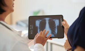 doctor reviewing lung scan from radon exposure